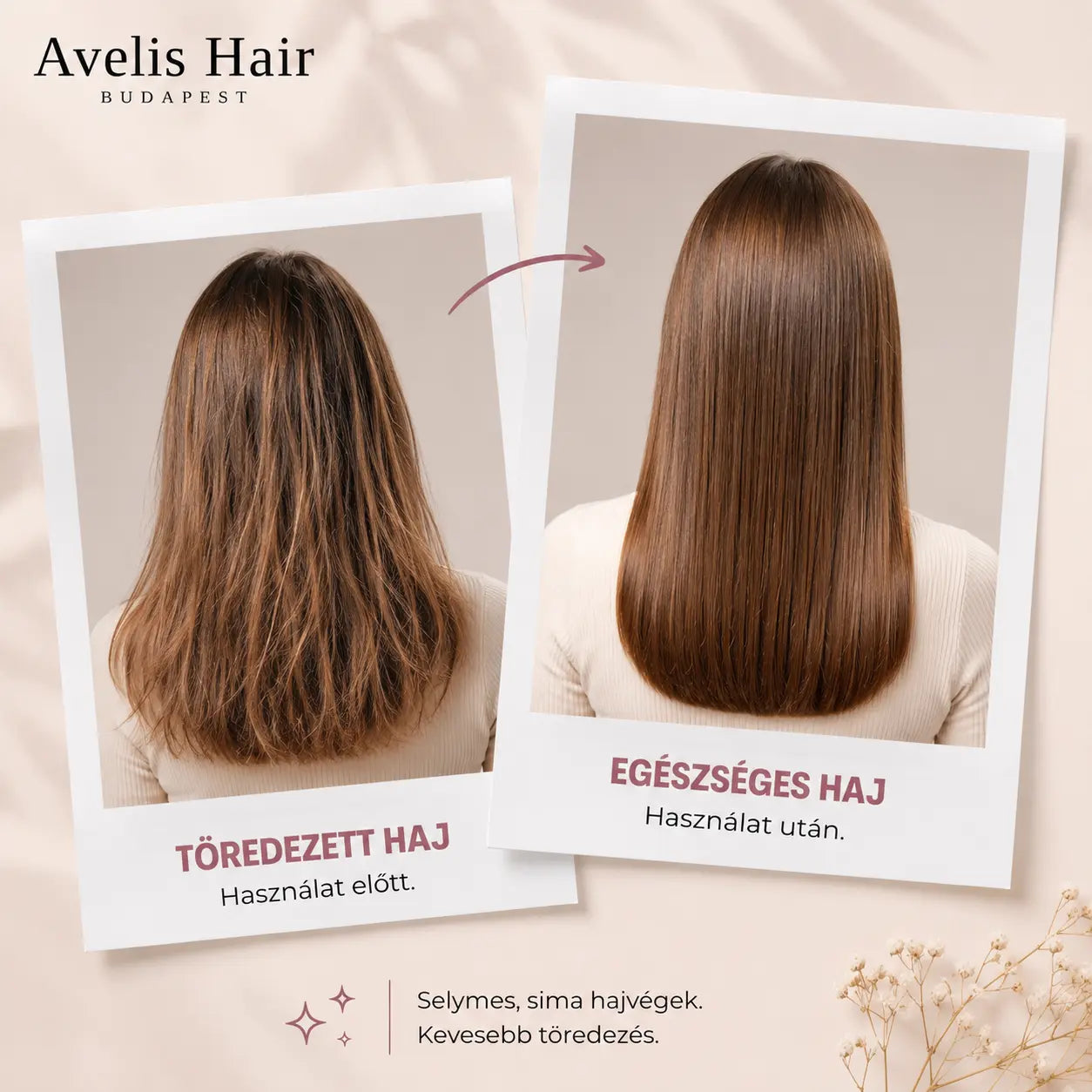 Avelis Splitfix™